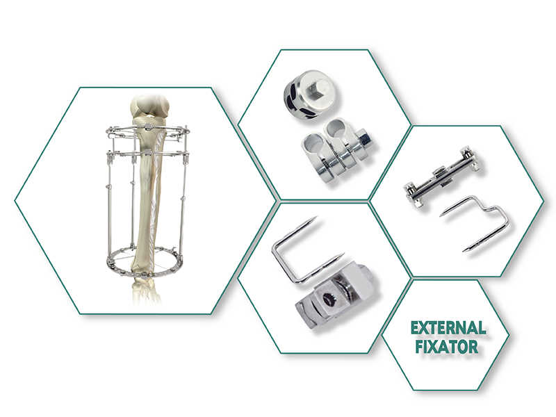 External Fixator